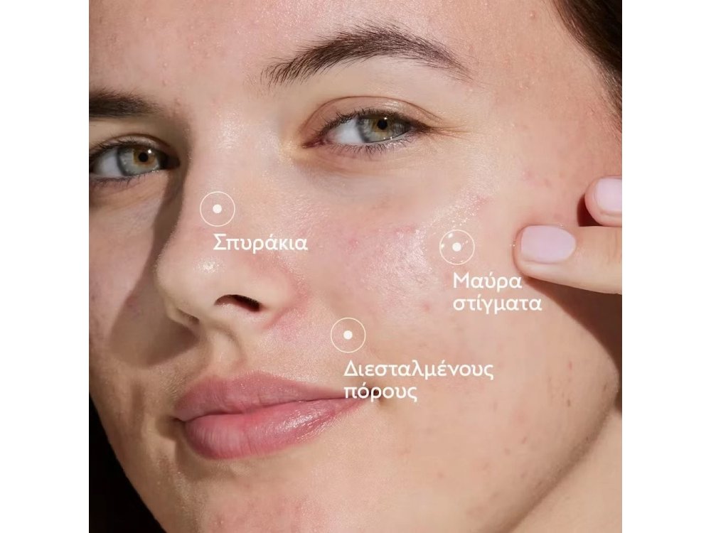 Caudalie Promo Vinopure Blemish Control Salicylic Serum 30ml & Δώρο Purifying Toner, 200ml