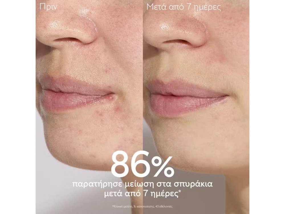 Caudalie Promo Vinopure Blemish Control Salicylic Serum 30ml & Δώρο Purifying Cleanser Gel, 150ml